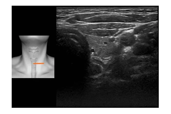 Ultrasound Images