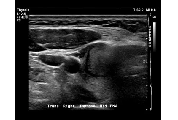 Ultrasound Images