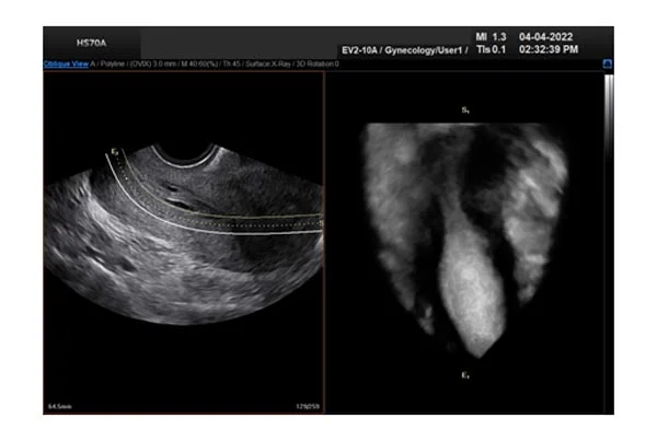Ultrasound Images