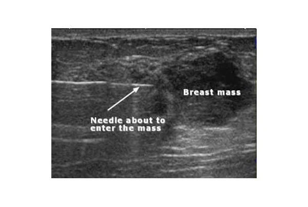 Ultrasound Images