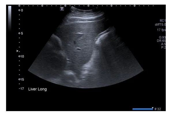 Ultrasound Images