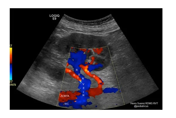 Ultrasound Images