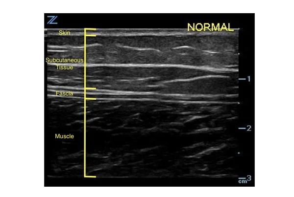 Ultrasound Images
