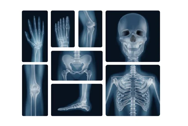 Ultrasound Images'