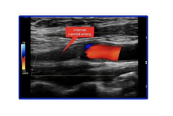 Ultrasound Images'