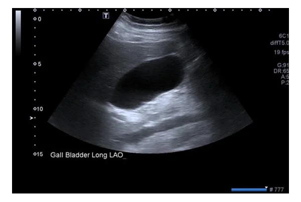 Ultrasound Images'