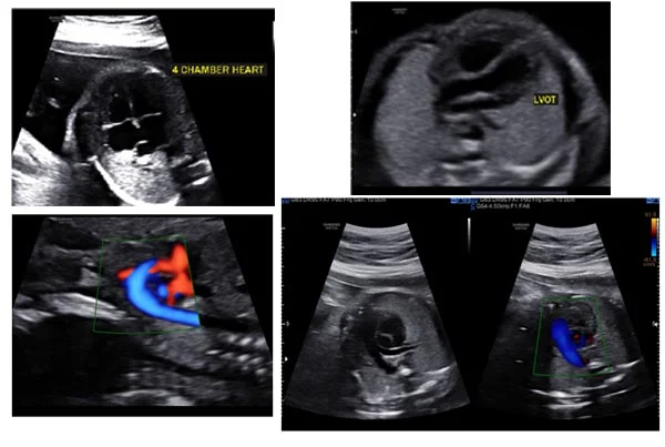 Ultrasound Images'
