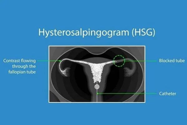 Ultrasound Images'