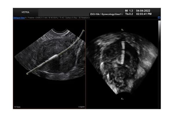 Ultrasound Images'